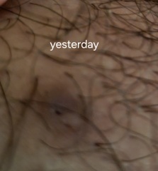 What's this?? Pubic area