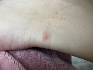 To ask for help with what is biting me?
