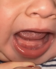 Teething?