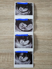 Boy or girl, any guesses?