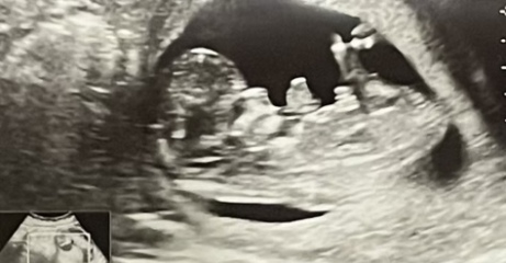 Gender Guesses, boy or girl?