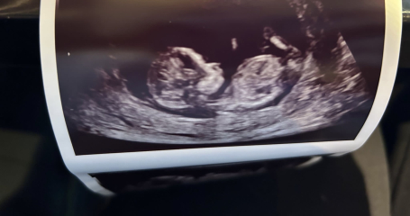 Gender guess?