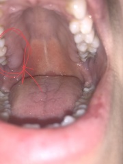 Help any dentists here? (warning grim picture!)