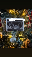 First ultrasound