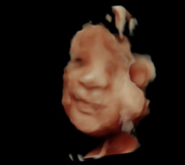 Due February 2024 Thread 5!! 🤰🩷💙