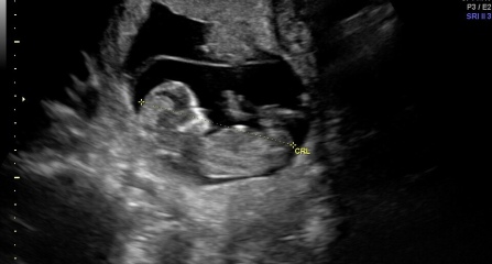 Nub theory - Can anyone guess the gender?