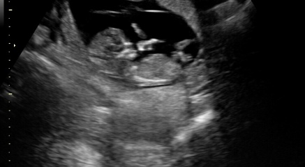 Nub theory - Can anyone guess the gender?