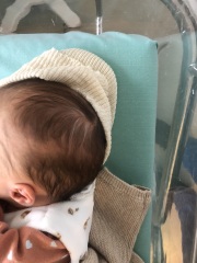 Very worried about newborn’s white hairs