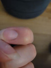 Finger lump