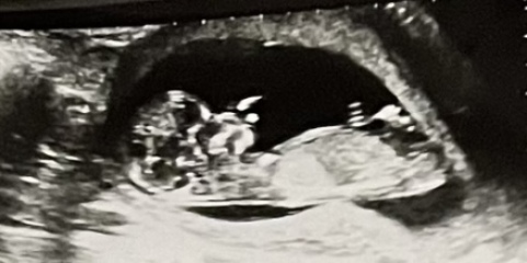 Gender Guesses, boy or girl?