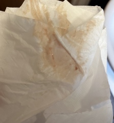 *TMI PIC* what is this discharge?