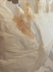 *TMI PIC* what is this discharge?
