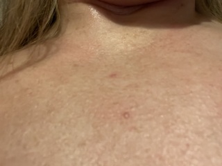 To ask what this rash could be..??