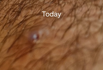 What's this?? Pubic area