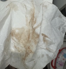 Am I miscarrying? TW:blood