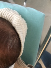 Very worried about newborn’s white hairs