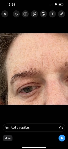 My face skin is terrible after pregnancy