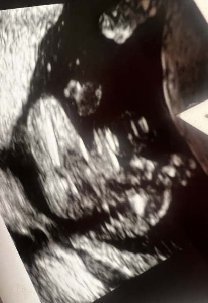 Potty shot gender confirmation??