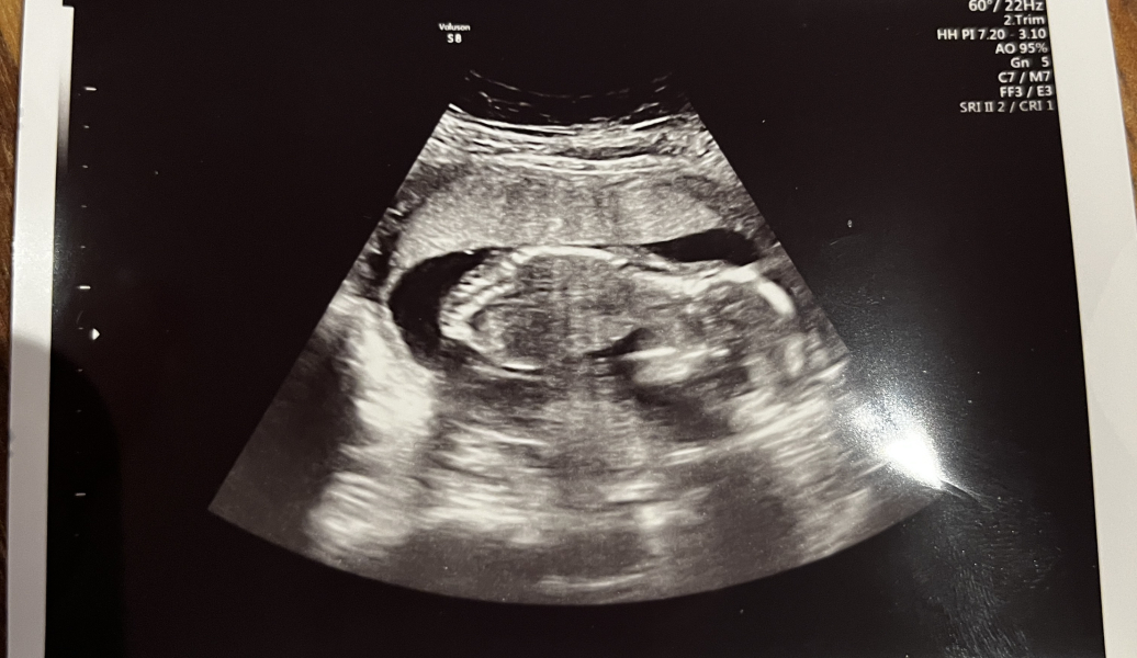 POAS come on you rainbows