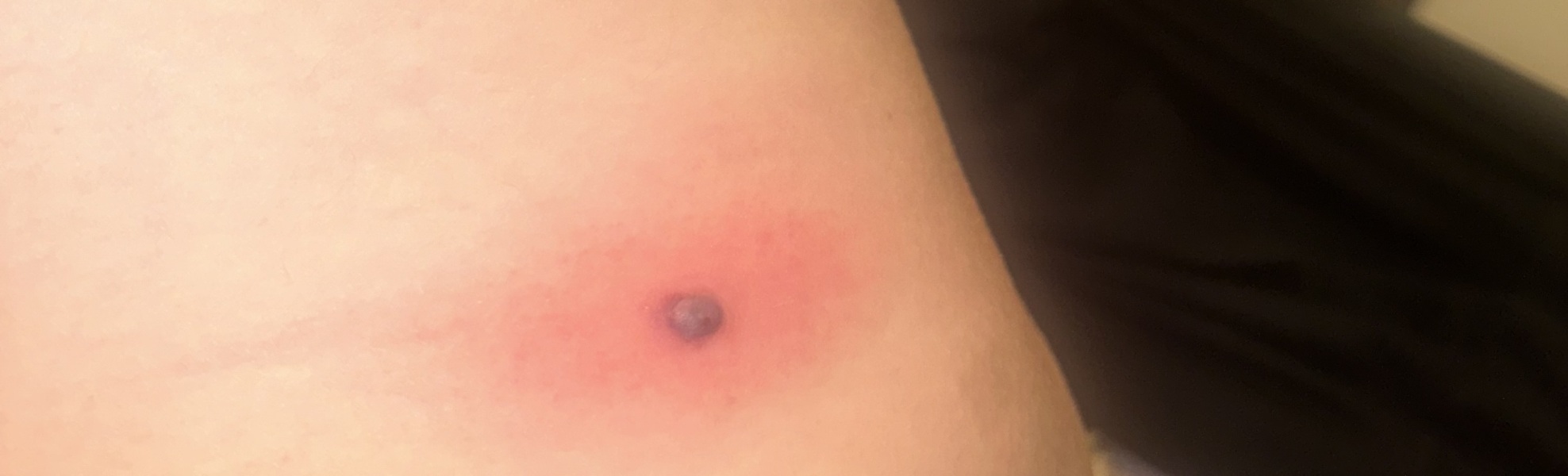 Can anyone identify this lump? (Medical, graphic photo!)