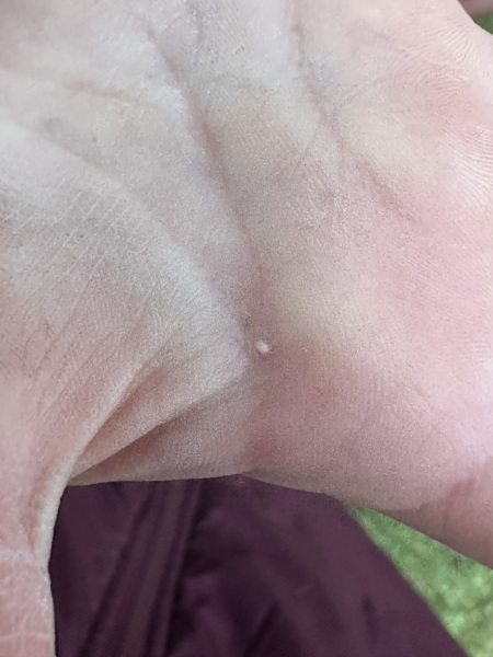 Spots on baby’s hand, what is it???