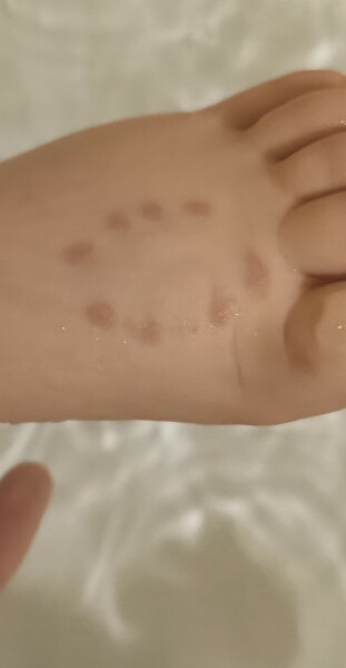 Aibu to worry about ds foot?