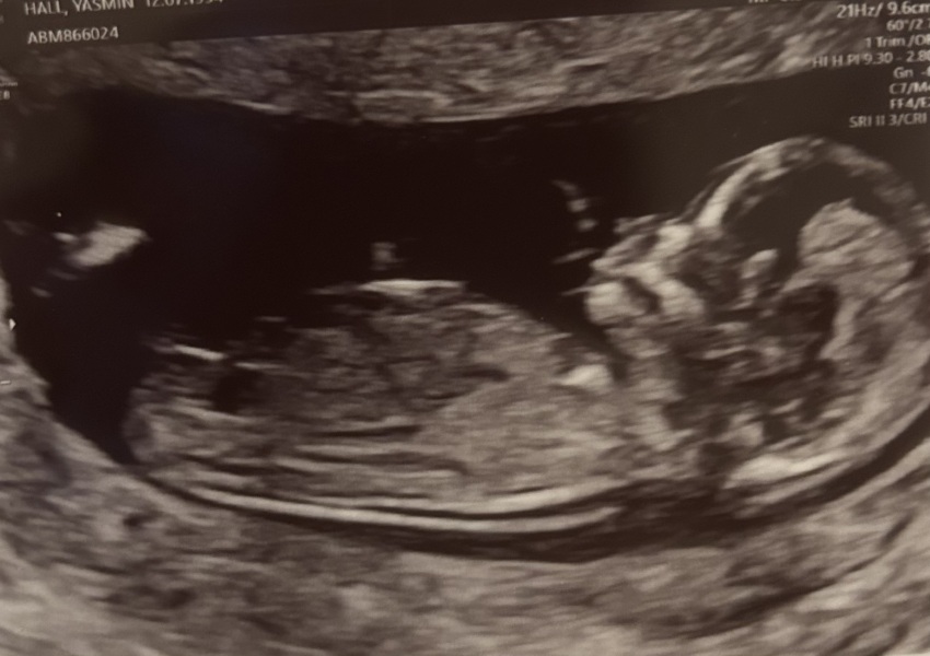 Nubologists question - any experiences?