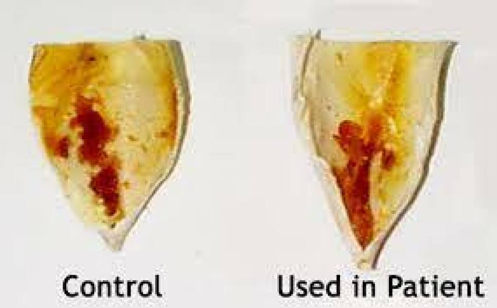 Look what came out my ear!