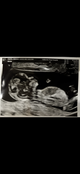12 week scan