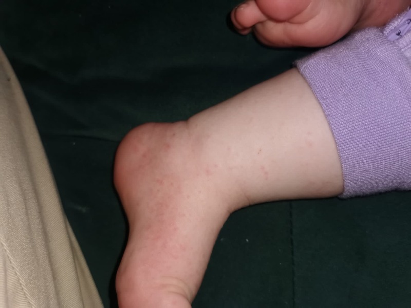 PLEASE HELP DAUGHTER SKIN