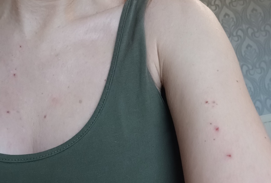 Any idea what these spots are?