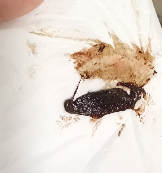 Brown clot at 7 weeks?