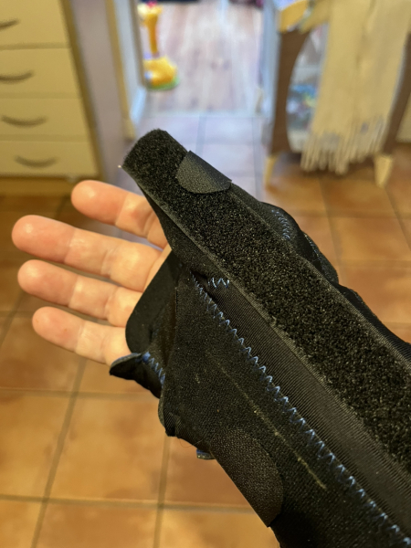 Is it possible to break a bone & not know?