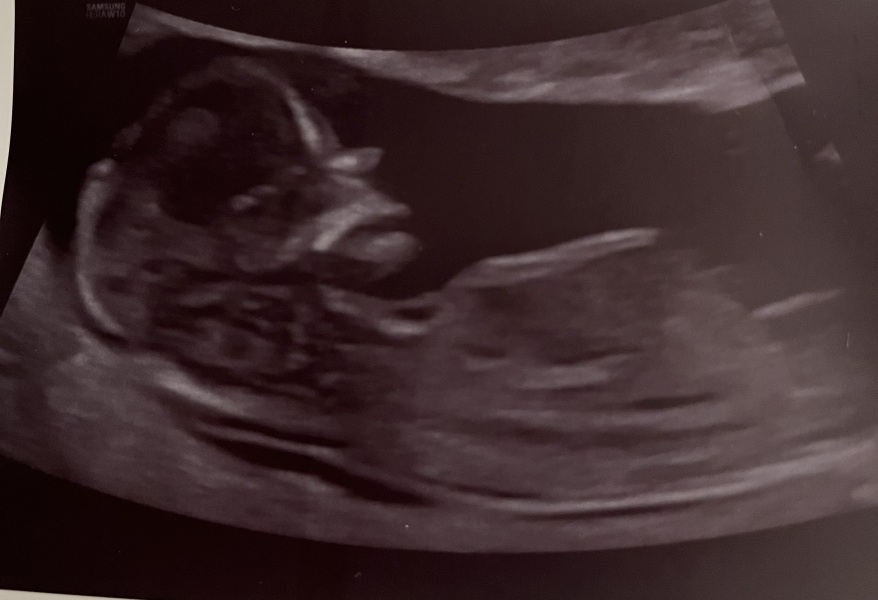 Nubologists question - any experiences?