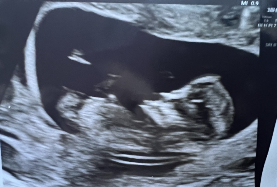 Boy or girl?