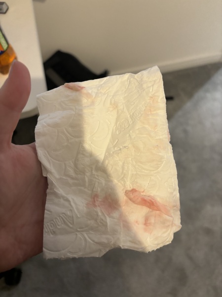 'Pregnancy after Miscarriage - Latest support thread'