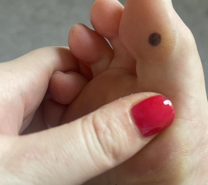 What is this on my foot??