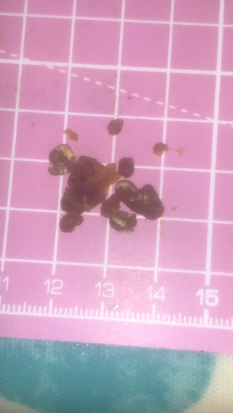 Look what came out my ear!