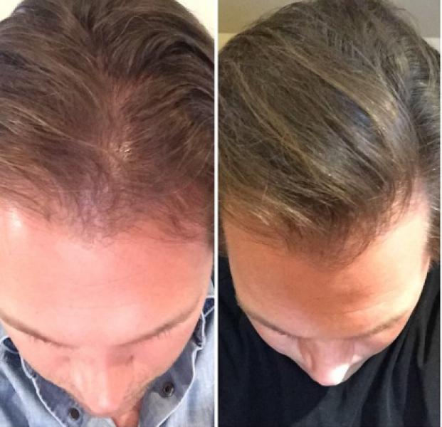 Highlight rut