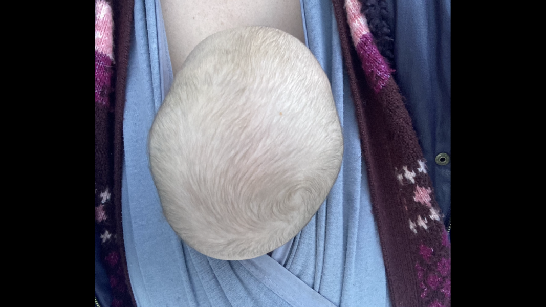 Craniosynostosis or am I over worrying?