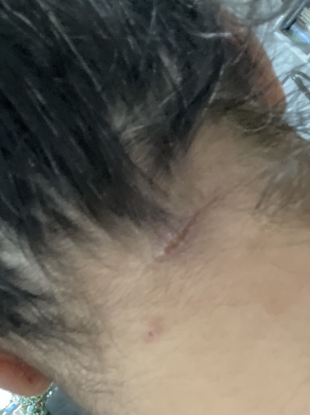 Does this need antibiotics?