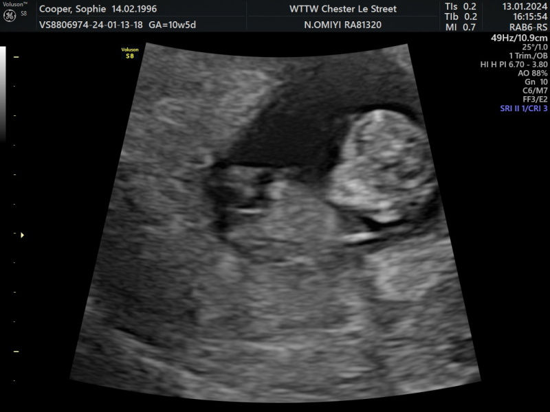 Boy or girl