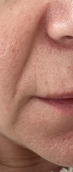 Help my lines and lips!! Pic attached…
