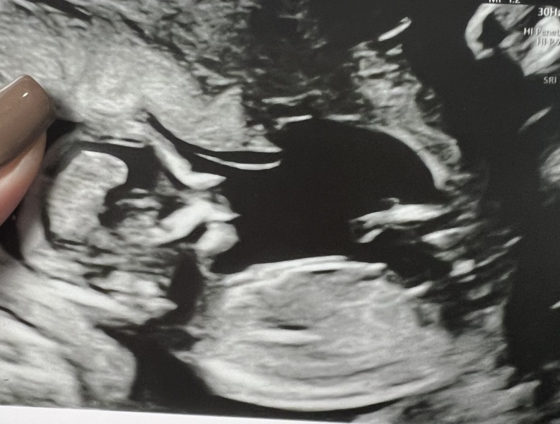 13+6 gender prediction?