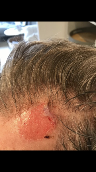 Would you be worried about my Dad’s wound?