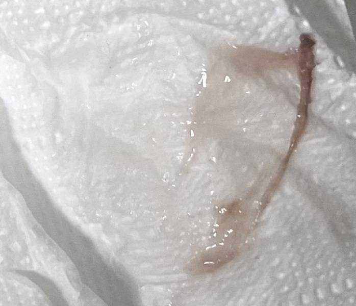 *TMI PIC* what does this look like?