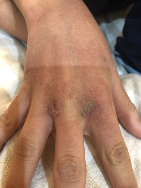 What is going on with my hand?