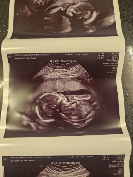 Boy or girl guesses