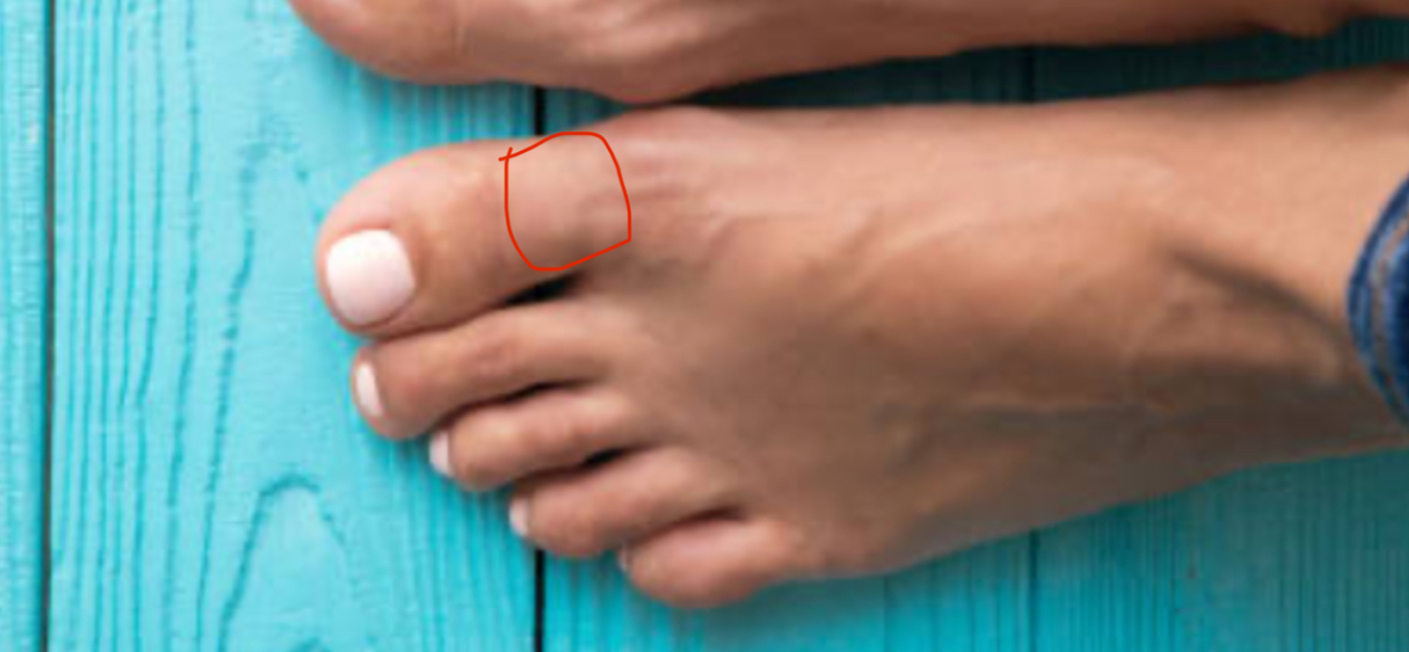 Who do I need to see about my foot?