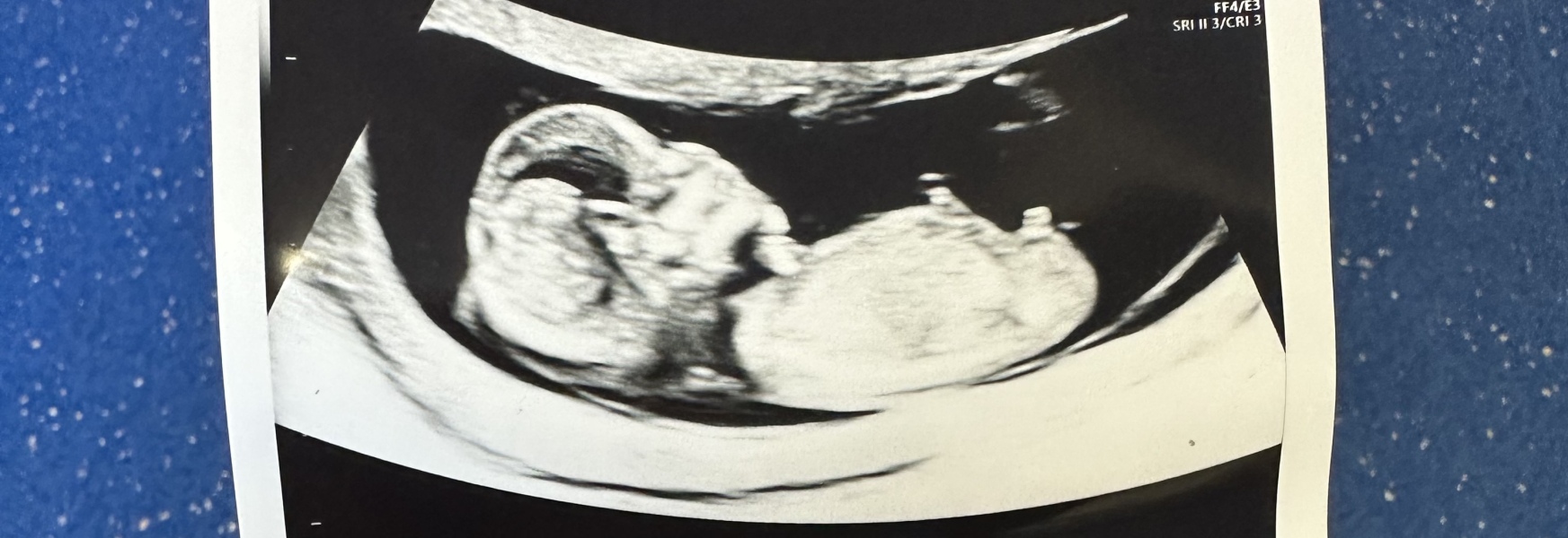 Any gender predictions??